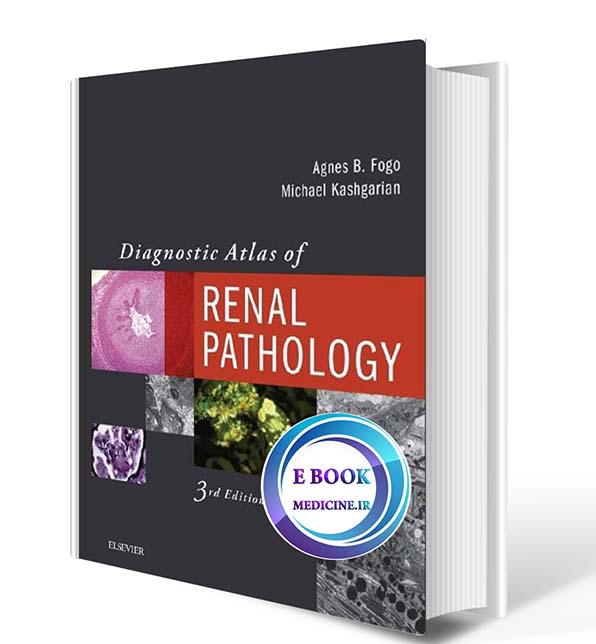 دانلود کتاب Diagnostic Atlas of Renal Pathology 3rd Edition 2017